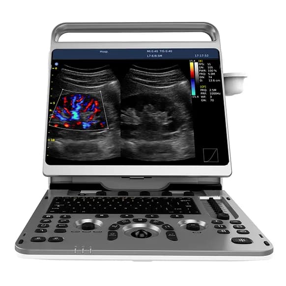 EBit 50 — Portativ ultratovush apparati