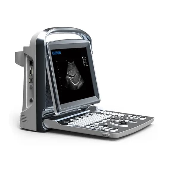 ECO 1 — Portativ ultratovush apparati