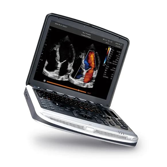 SonoBook 8 — УЗИ-система в формате ноутбука
