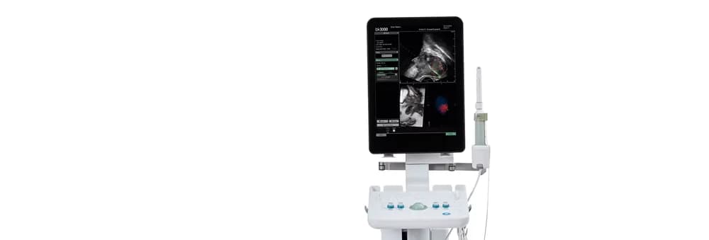 bkFusion–MRI-ultrasound Fusion Biopsy Solution — Ultratovush tizimi