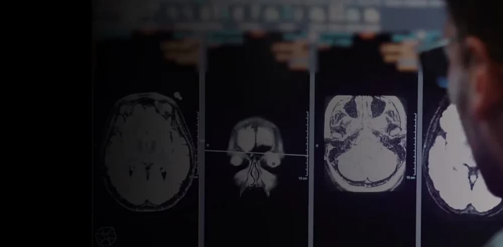 Upgrade to MR 30 for SIGNA MRI scanners — Magnit-rezonans tomograf