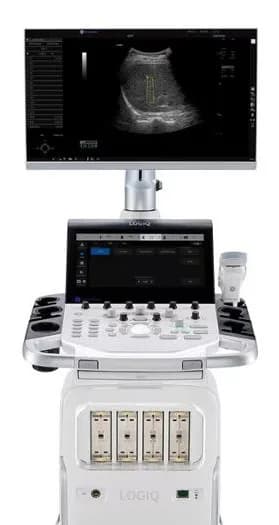 LOGIQ Totus Ultrasound — Ultratovush tizimi