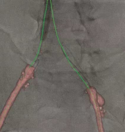 Liver Assist VP for Interventional Radiology and Oncology — Intraoperatsion navigatsiya tizimi