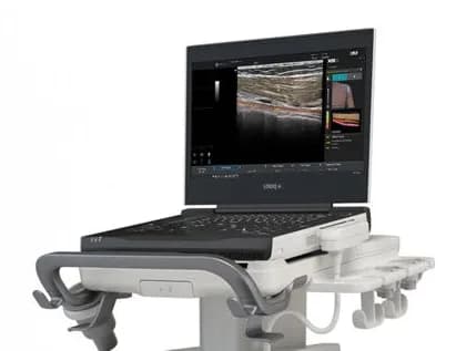 LOGIQ e X Ultrasound — Ultratovush tizimi