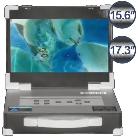 Ko'chma HD 1080P endoskopik tizim HD-320
