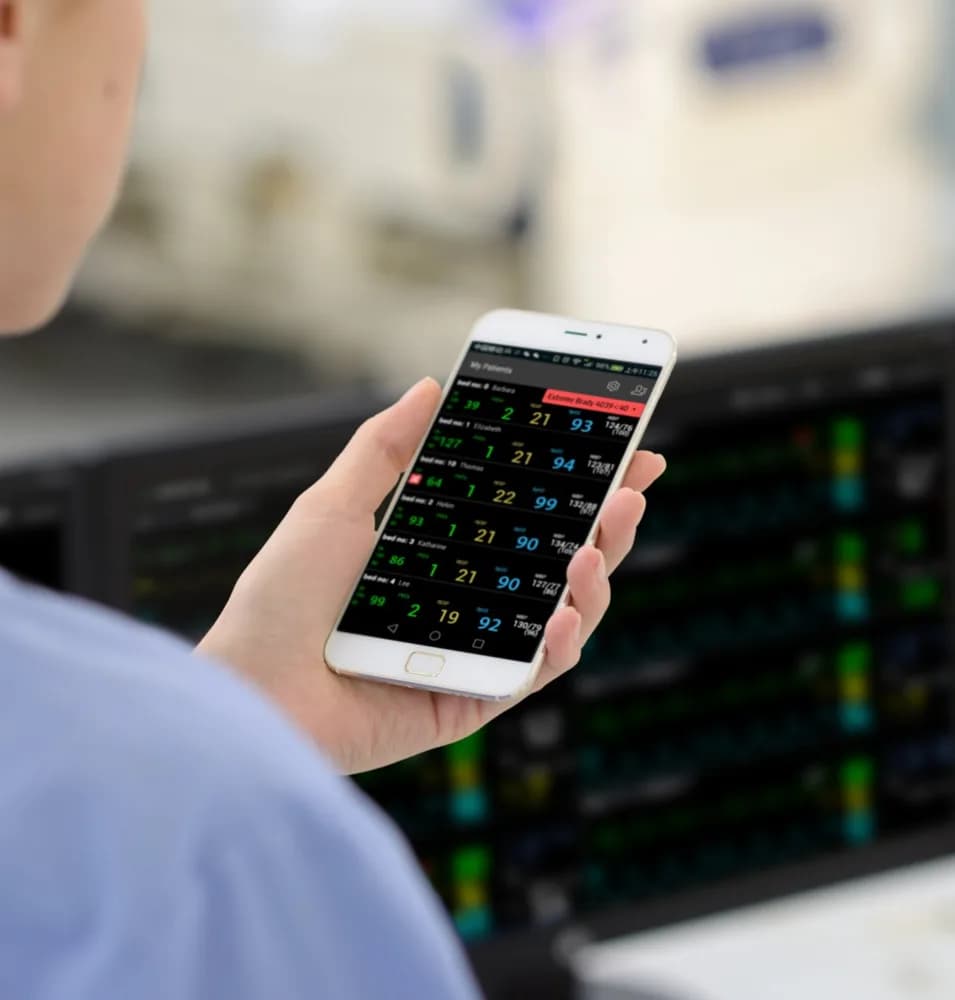 Mobile Viewer — Монитор пациента
