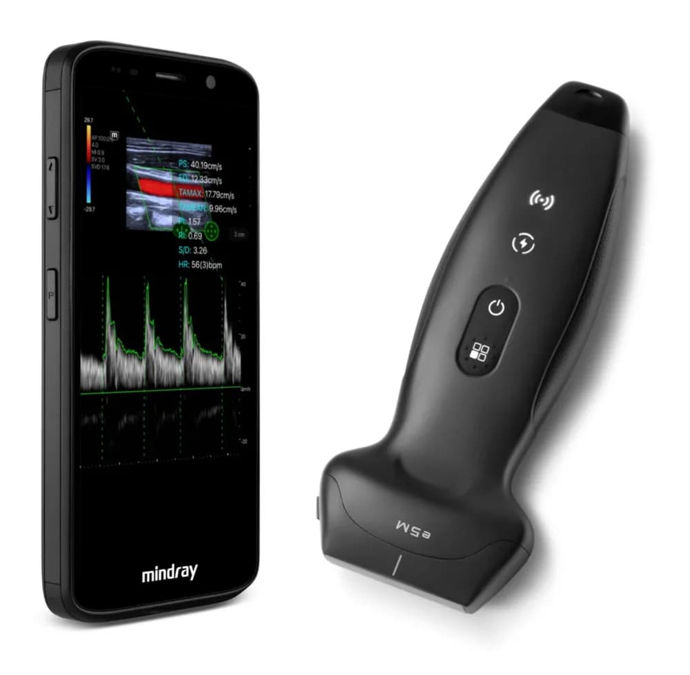 TE Air e5M — Ультразвуковая система